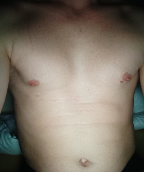 Napalony36